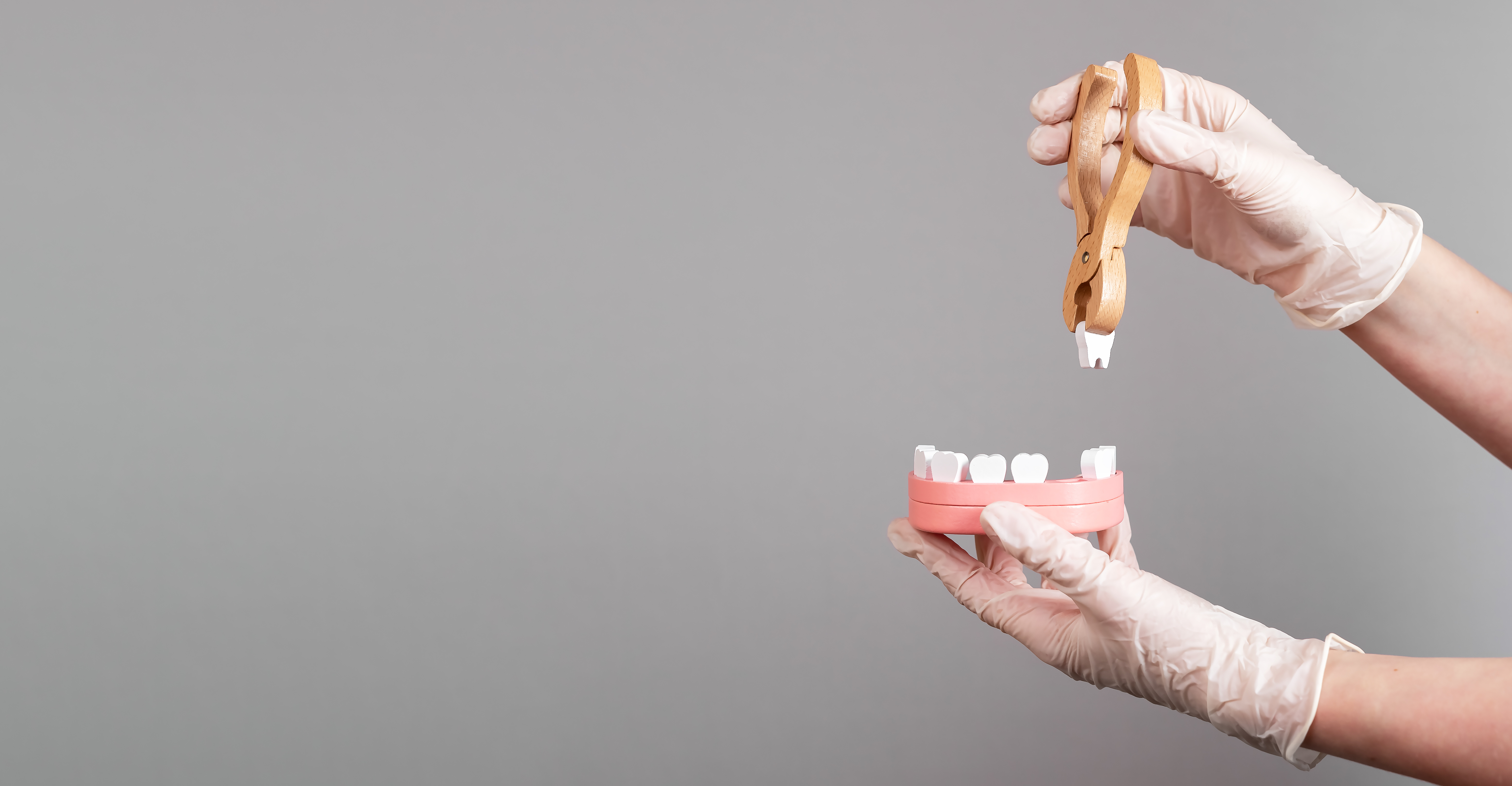 歯の模型と抜歯