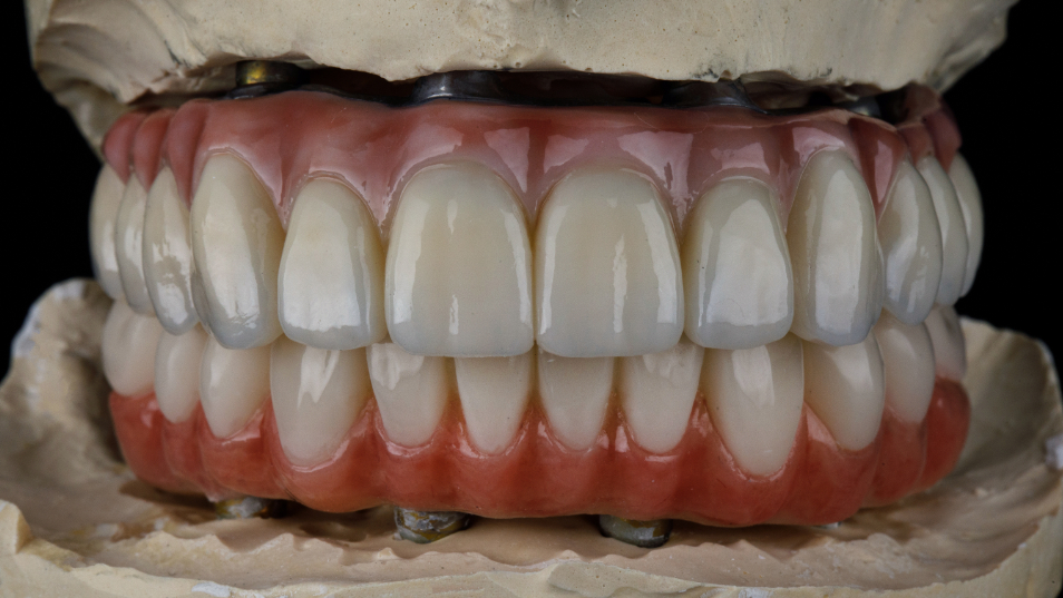 色の暗い歯茎