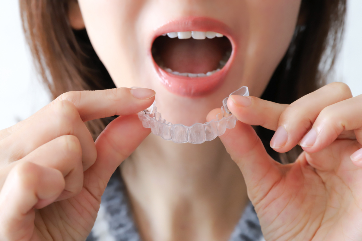 すきっ歯治療のためにマウスピース矯正をしている女性