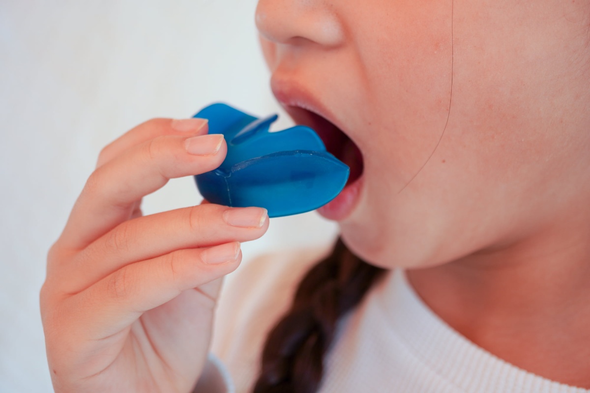 プレオルソを装着しようとしている子どもの口元